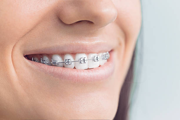 Best Wisdom Tooth Removal  in Cassville, MO